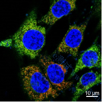 /information/image/2022/10/27/3447207a137a9d6e2461b8242b59854d.png image.png