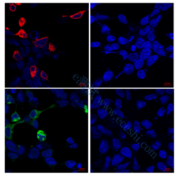 /information/image/2022/10/28/f873503050e864b72df30783e428b936.png 2.5.4-间接免疫荧光.png